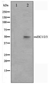 ZIC1+2+3 Antibody - Western blot of Jurkat cell lysate using ZIC1/2/3 Antibody