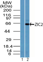 ZIC2 Antibody - Western blot of ZIC2 in HepG2 cell lysate using 1) pre-bleed, and 2) Polyclonal Antibody to ZIC2 at 5 ug/ml. Goat anti-rabbit Ig HRP secondary antibody, and PicoTect ECL substrate solution, were used for this test.