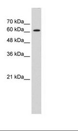 ZIC2 Antibody - HepG2 Cell Lysate.  This image was taken for the unconjugated form of this product. Other forms have not been tested.