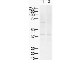 ZIC2 Antibody - Anti-ZIC2 Antibody - Western Blot. Western blot of Affinity Purified anti-ZIC2 antibody shows detection of a band ~55 kD (arrowhead) corresponding to ZIC2 in lysates from (lane 1) mouse brain and (lane 2) rat brain. Approximately 20 ug of each lysate was run on a SDS-PAGE and transferred onto nitrocellulose followed by reaction with a 1:500 dilution of anti-ZIC2 antibody. Signal was detected using standard techniques. The upper band in the mouse brain lysate represents Zic2.