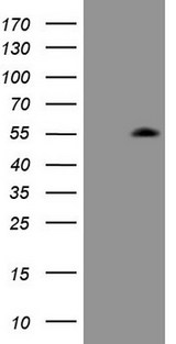 ZIC3 Antibody - HEK293T cells were transfected with the pCMV6-ENTRY control. (Left lane) or pCMV6-ENTRY ZIC3. (Right lane) cDNA for 48 hrs and lysed. Equivalent amounts of cell lysates. (5 ug per lane) were separated by SDS-PAGE and immunoblotted with anti-ZIC3. (1:2000)