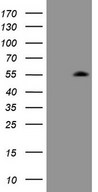 ZIC3 Antibody - HEK293T cells were transfected with the pCMV6-ENTRY control. (Left lane) or pCMV6-ENTRY ZIC3. (Right lane) cDNA for 48 hrs and lysed. Equivalent amounts of cell lysates. (5 ug per lane) were separated by SDS-PAGE and immunoblotted with anti-ZIC3. (1:2000)