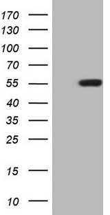 ZIC3 Antibody - HEK293T cells were transfected with the pCMV6-ENTRY control. (Left lane) or pCMV6-ENTRY ZIC3. (Right lane) cDNA for 48 hrs and lysed. Equivalent amounts of cell lysates. (5 ug per lane) were separated by SDS-PAGE and immunoblotted with anti-ZIC3. (1:500)