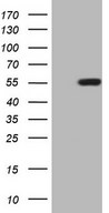 ZIC3 Antibody - HEK293T cells were transfected with the pCMV6-ENTRY control. (Left lane) or pCMV6-ENTRY ZIC3. (Right lane) cDNA for 48 hrs and lysed. Equivalent amounts of cell lysates. (5 ug per lane) were separated by SDS-PAGE and immunoblotted with anti-ZIC3. (1:500)