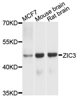 ZIC3 Antibody - Western blot analysis of extracts of various cells.