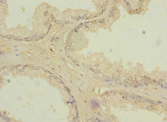 ZIC3 Antibody - Immunohistochemistry of paraffin-embedded human prostate tissue at dilution 1:100