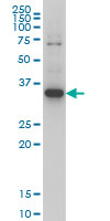 ZIC4 Antibody - ZIC4 monoclonal antibody (M05), clone 1A9 Western blot of ZIC4 expression in HeLa NE.