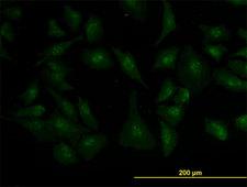 ZIC4 Antibody - Immunofluorescence of monoclonal antibody to ZIC4 on HeLa cell (antibody concentration 10 ug/ml).