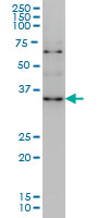 ZIC4 Antibody - ZIC4 monoclonal antibody (M09), clone 3A2 Western blot of ZIC4 expression in HeLa NE.