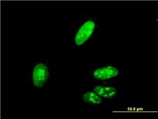 ZIC4 Antibody - Immunofluorescence of monoclonal antibody to ZIC4 on HeLa cell (antibody concentration 10 ug/ml).
