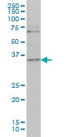 ZIC4 Antibody - ZIC4 monoclonal antibody (M06), clone 3D5 Western blot of ZIC4 expression in HeLa NE.