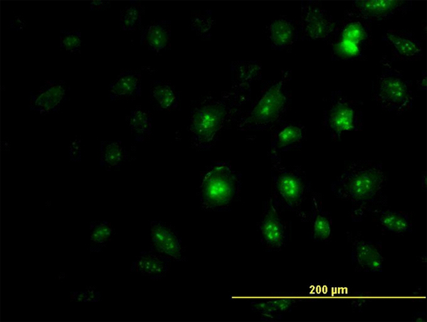ZIC4 Antibody - Immunofluorescence of monoclonal antibody to ZIC4 on HeLa cell (antibody concentration 7 ug/ml).