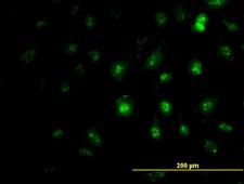 ZIC4 Antibody - Immunofluorescence of monoclonal antibody to ZIC4 on HeLa cell (antibody concentration 7 ug/ml).
