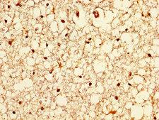 ZIC4 Antibody - Immunohistochemistry image at a dilution of 1:200 and staining in paraffin-embedded human brain tissue performed on a Leica BondTM system. After dewaxing and hydration, antigen retrieval was mediated by high pressure in a citrate buffer (pH 6.0) . Section was blocked with 10% normal goat serum 30min at RT. Then primary antibody (1% BSA) was incubated at 4 °C overnight. The primary is detected by a biotinylated secondary antibody and visualized using an HRP conjugated SP system.