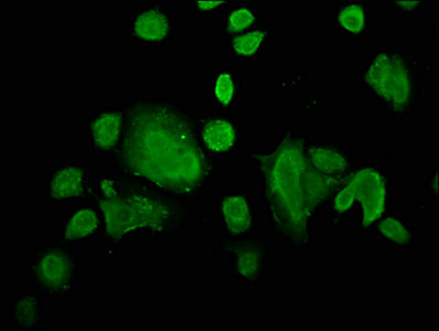 ZIC4 Antibody - Immunofluorescence staining of MCF-7 cells with ZIC4 Antibody at 1:66, counter-stained with DAPI. The cells were fixed in 4% formaldehyde, permeabilized using 0.2% Triton X-100 and blocked in 10% normal Goat Serum. The cells were then incubated with the antibody overnight at 4°C. The secondary antibody was Alexa Fluor 488-congugated AffiniPure Goat Anti-Rabbit IgG(H+L).