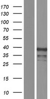 ZIC4 Protein - Western validation with an anti-DDK antibody * L: Control HEK293 lysate R: Over-expression lysate