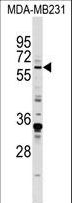ZIF268 / EGR1 Antibody - EGR1 Antibody western blot of MDA-MB231 cell line lysates (35 ug/lane). The EGR1 antibody detected the EGR1 protein (arrow).