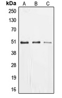 ZIF268 / EGR1 Antibody - Western blot analysis of EGR1 expression in MCF7 (A); SHSY5Y (B); PC12 (C) whole cell lysates.