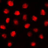 ZIF268 / EGR1 Antibody - Immunofluorescent analysis of EGR1 staining in MCF7 cells. Formalin-fixed cells were permeabilized with 0.1% Triton X-100 in TBS for 5-10 minutes and blocked with 3% BSA-PBS for 30 minutes at room temperature. Cells were probed with the primary antibody in 3% BSA-PBS and incubated overnight at 4 C in a humidified chamber. Cells were washed with PBST and incubated with a DyLight 594-conjugated secondary antibody (red) in PBS at room temperature in the dark. DAPI was used to stain the cell nuclei (blue).