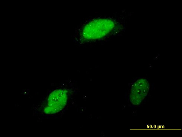 ZIF268 / EGR1 Antibody - Immunofluorescence of monoclonal antibody to EGR1 on HeLa cell (antibody concentration 10 ug/ml).