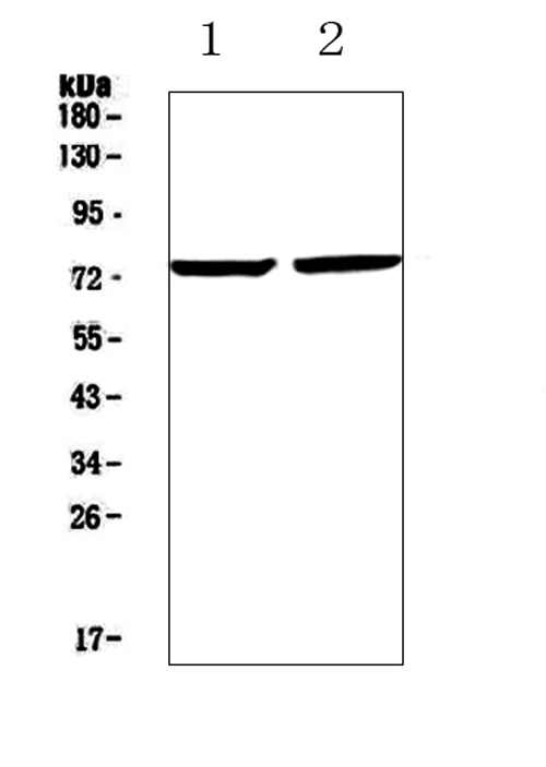 ZIF268 / EGR1 Antibody - Western blot analysis of Egr1 using anti-Egr1 antibody. Electrophoresis was performed on a 5-20% SDS-PAGE gel at 70V (Stacking gel) / 90V (Resolving gel) for 2-3 hours. The sample well of each lane was loaded with 50ug of sample under reducing conditions. Lane 1: human 22RV1 whole cell lysates, Lane 2: human PANC-1 whole cell lysates. After Electrophoresis, proteins were transferred to a Nitrocellulose membrane at 150mA for 50-90 minutes. Blocked the membrane with 5% Non-fat Milk/ TBS for 1.5 hour at RT. The membrane was incubated with rabbit anti-Egr1 antigen affinity purified polyclonal antibody at 0.5 µg/mL overnight at 4°C, then washed with TBS-0.1% Tween 3 times with 5 minutes each and probed with a goat anti-rabbit IgG-HRP secondary antibody at a dilution of 1:10000 for 1.5 hour at RT. The signal is developed using an Enhanced Chemiluminescent detection (ECL) kit with Tanon 5200 system. A specific band was detected for Egr1 at approximately 75KD. The expected band size for Egr1 is at 58KD.