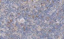 ZIF268 / EGR1 Antibody - 1:100 staining human lymph node tissue by IHC-P. The tissue was formaldehyde fixed and a heat mediated antigen retrieval step in citrate buffer was performed. The tissue was then blocked and incubated with the antibody for 1.5 hours at 22°C. An HRP conjugated goat anti-rabbit antibody was used as the secondary.