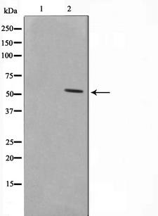 ZIF268 / EGR1 Antibody - Western blot analysis on HT29 cell lysates using NAB2 antibody. The lane on the left is treated with the antigen-specific peptide.