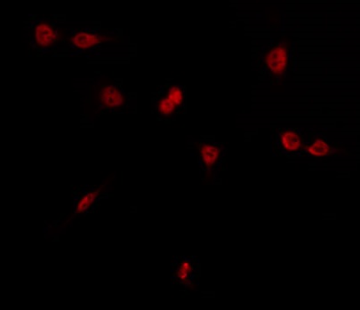 ZIF268 / EGR1 Antibody - Staining HT29 cells by IF/ICC. The samples were fixed with PFA and permeabilized in 0.1% Triton X-100, then blocked in 10% serum for 45 min at 25°C. The primary antibody was diluted at 1:200 and incubated with the sample for 1 hour at 37°C. An Alexa Fluor 594 conjugated goat anti-rabbit IgG (H+L) Ab, diluted at 1/600, was used as the secondary antibody.
