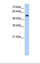 ZIK1 Antibody - Jurkat cell lysate. Antibody concentration: 1.25 ug/ml. Gel concentration: 12%.  This image was taken for the unconjugated form of this product. Other forms have not been tested.