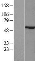 ZIK1 Protein - Western validation with an anti-DDK antibody * L: Control HEK293 lysate R: Over-expression lysate