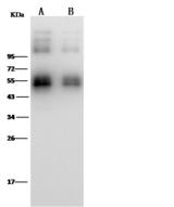 Zika Virus NS1 Antibody - Anti-Zika virus(ZIKV)(strain Zika SPH2015)ZIKV-SN1 mouse monoclonal antibody at 1:1000 dilution.Sample: Zika virus(ZIKV)(strain Zika SPH2015)ZIKV-SN1 Recombinant Protein. Lane A: 30ng. Lane B: 10ng. Secondary: Rabbit Anti-Mouse IgG F(ab)2/HRP at 1/10000 dilution. Developed using the ECL technique. Performed under reducing conditions.