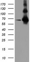 ZIM2 Antibody - HEK293T cells were transfected with the pCMV6-ENTRY control (Left lane) or pCMV6-ENTRY ZIM2 (Right lane) cDNA for 48 hrs and lysed. Equivalent amounts of cell lysates (5 ug per lane) were separated by SDS-PAGE and immunoblotted with anti-ZIM2.