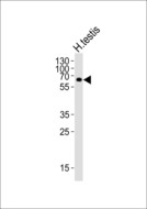 ZIM2 Antibody - Western blot of lysate from human testis tissue lysate with ZIM2 Antibody. Antibody was diluted at 1:1000. A goat anti-rabbit IgG H&L (HRP) at 1:10000 dilution was used as the secondary antibody. Lysate at 35 ug.