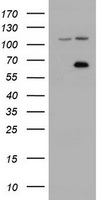 ZIM2 Antibody - HEK293T cells were transfected with the pCMV6-ENTRY control (Left lane) or pCMV6-ENTRY ZIM2 (Right lane) cDNA for 48 hrs and lysed. Equivalent amounts of cell lysates (5 ug per lane) were separated by SDS-PAGE and immunoblotted with anti-ZIM2.
