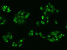 ZIM2 Antibody - Immunofluorescence staining of ZIM2 in HepG2 cells. Cells were fixed with 4% PFA, permeabilzed with 0.1% Triton X-100 in PBS, blocked with 10% serum, and incubated with rabbit anti-Human ZIM2 polyclonal antibody (dilution ratio 1:200) at 4°C overnight. Then cells were stained with the Alexa Fluor 488-conjugated Goat Anti-rabbit IgG secondary antibody (green). Positive staining was localized to Nucleus.
