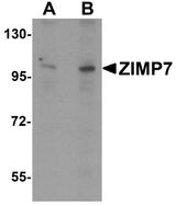 ZIMP7 / ZMIZ2 Antibody - Western blot analysis of ZIMP7 in A20 cell lysate with ZIMP7 antibody at (A) 0.25 ug/ml and (B) 0.5 ug/ml.