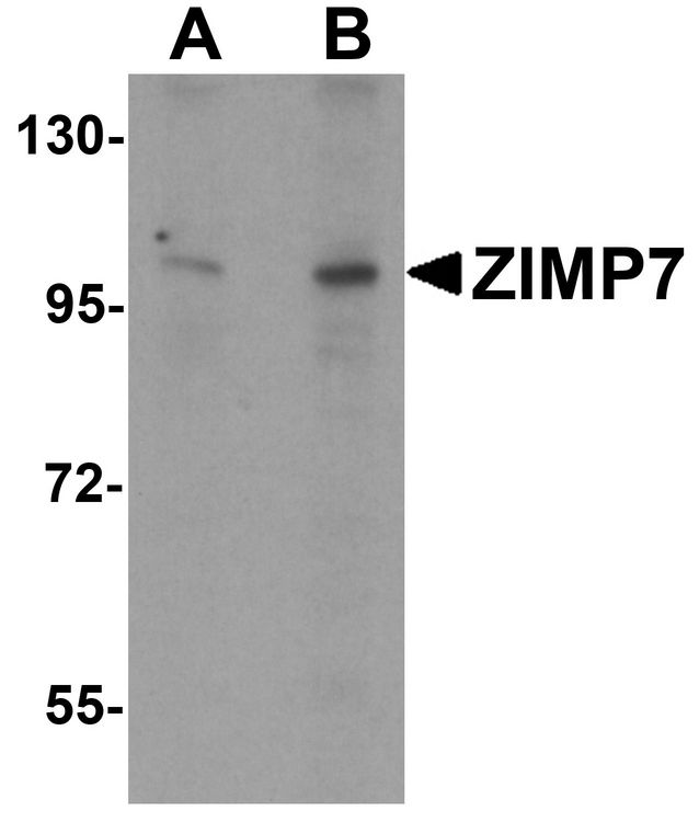 ZIMP7 / ZMIZ2 Antibody - Western blot analysis of ZIMP7 in A20 cell lysate with ZIMP7 antibody at (A) 0.25 ug/ml and (B) 0.5 ug/ml.