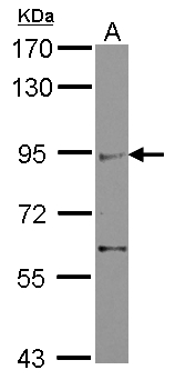 ZIMP7 / ZMIZ2 Antibody - Sample (30 ug of whole cell lysate) A: IMR32 7.5% SDS PAGE ZMIZ2 antibody diluted at 1:500