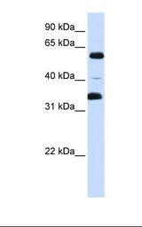 ZKSCAN1 / ZNF36 Antibody - Fetal brain lysate. Antibody concentration: 1.0 ug/ml. Gel concentration: 12%.  This image was taken for the unconjugated form of this product. Other forms have not been tested.