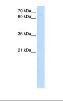 ZKSCAN1 / ZNF36 Antibody - Jurkat cell lysate. Antibody concentration: 5.0 ug/ml. Gel concentration: 12%.  This image was taken for the unconjugated form of this product. Other forms have not been tested.