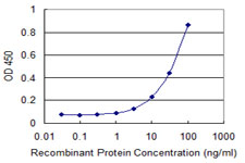 ZKSCAN1 / ZNF36 Antibody - Detection limit for recombinant GST tagged ZKSCAN1 is 1 ng/ml as a capture antibody.