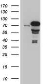 ZKSCAN1 / ZNF36 Antibody - HEK293T cells were transfected with the pCMV6-ENTRY control. (Left lane) or pCMV6-ENTRY ZKSCAN1. (Right lane) cDNA for 48 hrs and lysed. Equivalent amounts of cell lysates. (5 ug per lane) were separated by SDS-PAGE and immunoblotted with anti-ZKSCAN1. (1:2000)