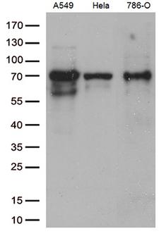 ZKSCAN1 / ZNF36 Antibody - Western blot analysis of extracts. (35ug) from 3 cell lines by using anti-ZKSCAN1 monoclonal antibody. (1:500)