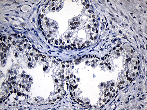 ZKSCAN1 / ZNF36 Antibody - Immunohistochemical staining of paraffin-embedded Human prostate tissue within the normal limits using anti-ZKSCAN1 mouse monoclonal antibody. (Heat-induced epitope retrieval by 1mM EDTA in 10mM Tris buffer. (pH8.5) at 120°C for 3 min. (1:500)