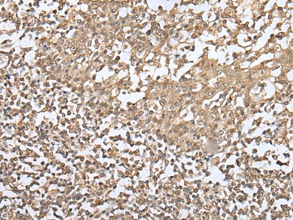 ZKSCAN1 / ZNF36 Antibody - Immunohistochemistry of paraffin-embedded Human tonsil tissue  using ZKSCAN1 Polyclonal Antibody at dilution of 1:30(×200)