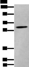 ZKSCAN1 / ZNF36 Antibody - Western blot analysis of Human cerebrum tissue lysate  using ZKSCAN1 Polyclonal Antibody at dilution of 1:400