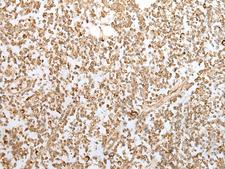 ZKSCAN1 / ZNF36 Antibody - Immunohistochemistry of paraffin-embedded Human tonsil tissue  using ZKSCAN1 Polyclonal Antibody at dilution of 1:30(×200)