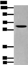 ZKSCAN1 / ZNF36 Antibody - Western blot analysis of Human cerebrum tissue lysate  using ZKSCAN1 Polyclonal Antibody at dilution of 1:400