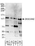 ZKSCAN2 Antibody - Detection of Human ZKSCAN2 by Western Blot. Samples: Whole cell lysate from HeLa (15 and 50 ug), 293T (T; 50 ug) and Jurkat (J; 50 ug) cells. Antibodies: Affinity purified rabbit anti-ZKSCAN2 antibody used for WB at 1 ug/ml. Detection: Chemiluminescence with an exposure time of 3 minutes.