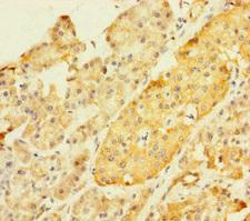 ZKSCAN2 Antibody - Immunohistochemistry of paraffin-embedded human pancreatic tissue using ZKSCAN2 Antibody at dilution of 1:100